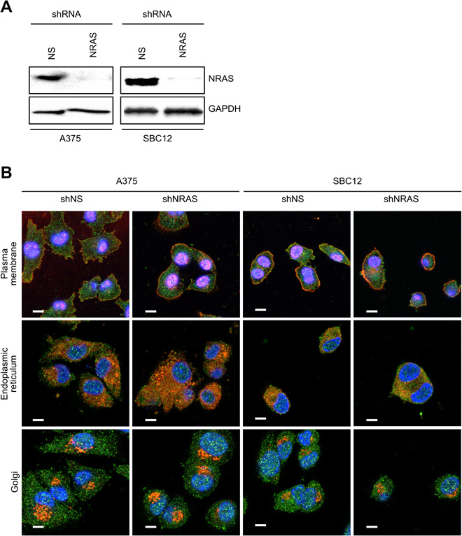 Scientists lay the foundation for better research into anti-RAS ...